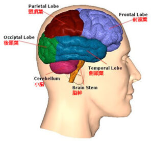 brain1